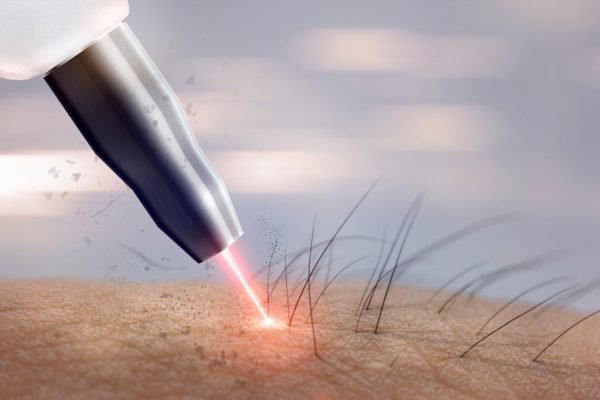 jak wybrac laser biznes laserowy magdalena atta-motte